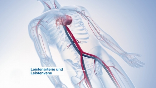 心脏手术三维动画